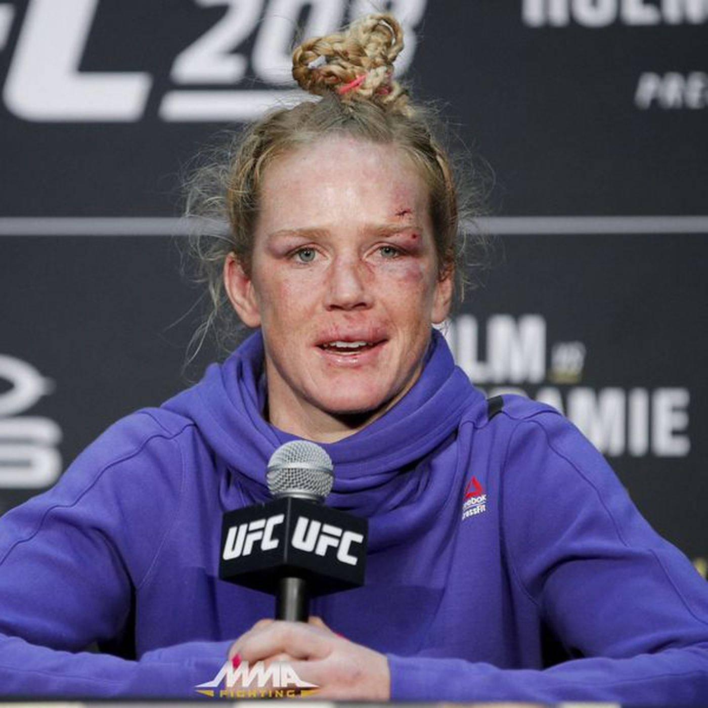 Holly Holm臉部帶傷 壁紙 — 一位女性UFC拳手，臉上帶有明顯瘀傷和傷口，在記者會上情緒激動地對著麥克風發言。