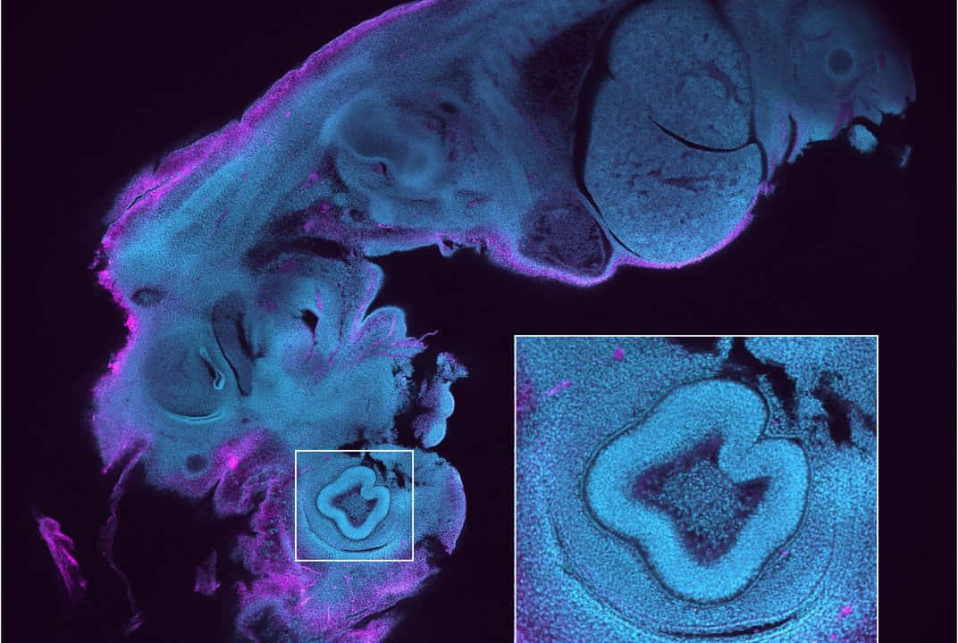 帶有放大插圖的生物組織熒光顯微鏡圖像。
