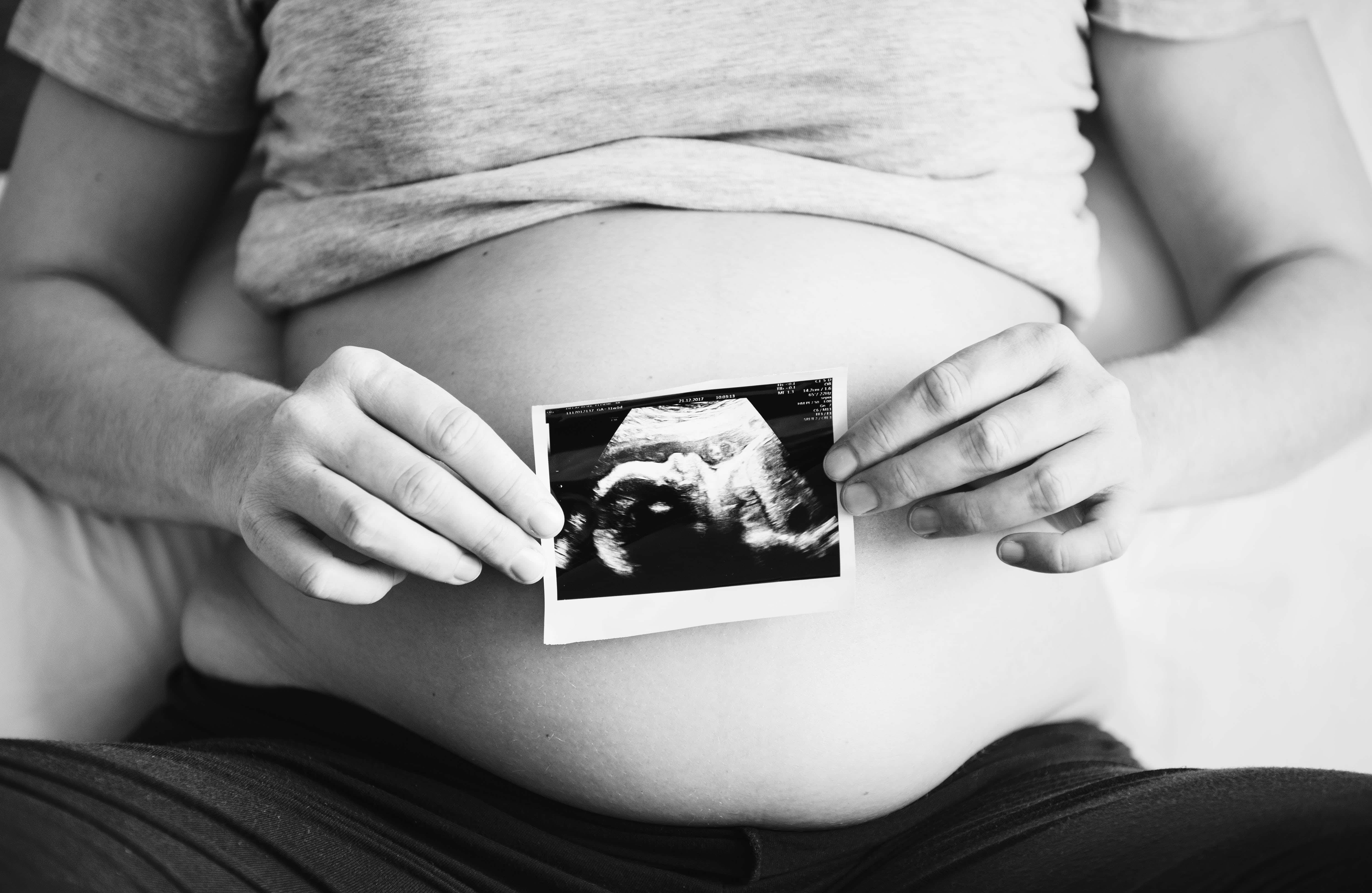 pregnancy 桌布 壁紙 — 一位孕婦在溫柔的黑白特寫中，將超聲波照片放在肚子上。