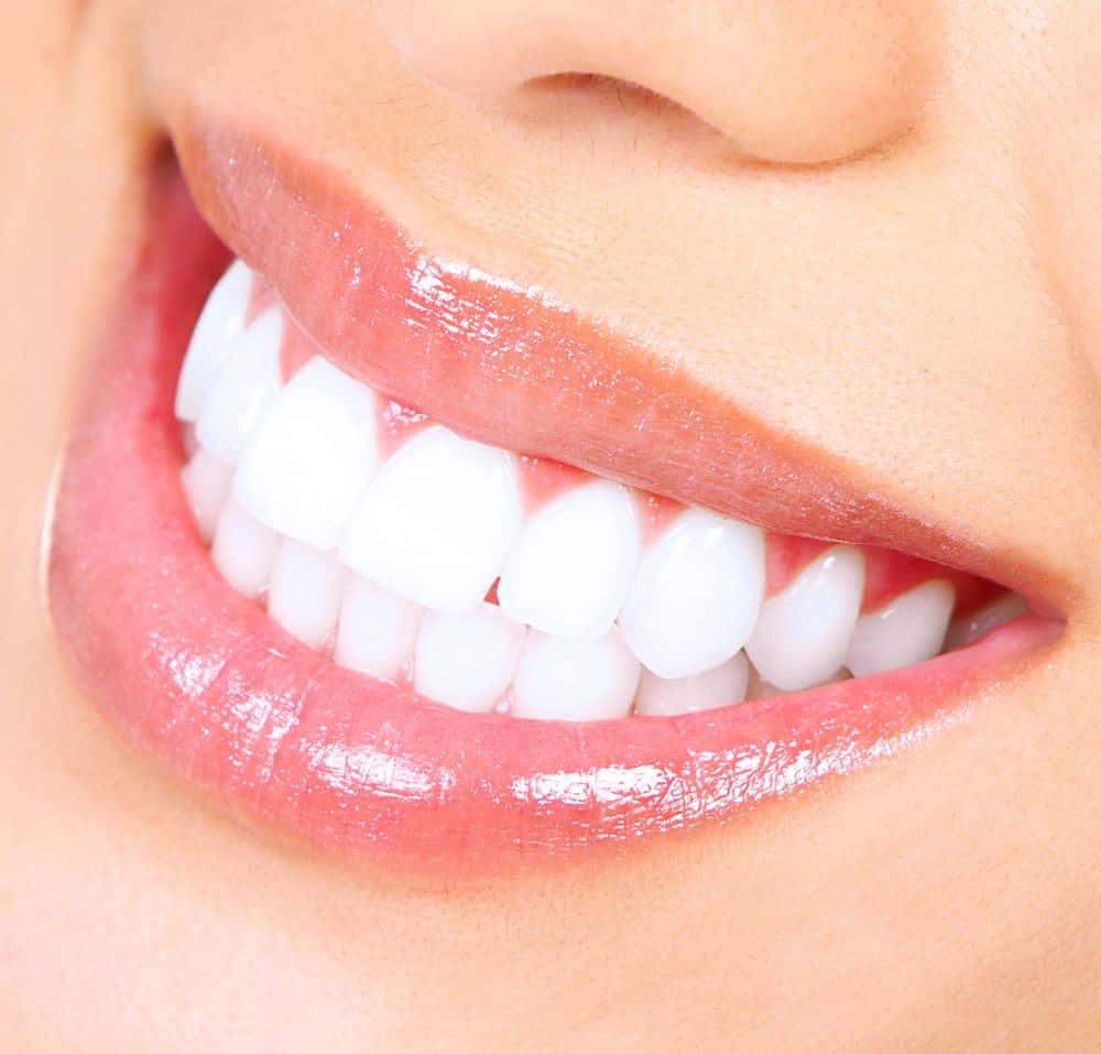Teeth Whitening 桌布 壁紙 — 一個燦爛笑容的特寫，展示完美潔白的牙齒和光澤的粉紅嘴唇。