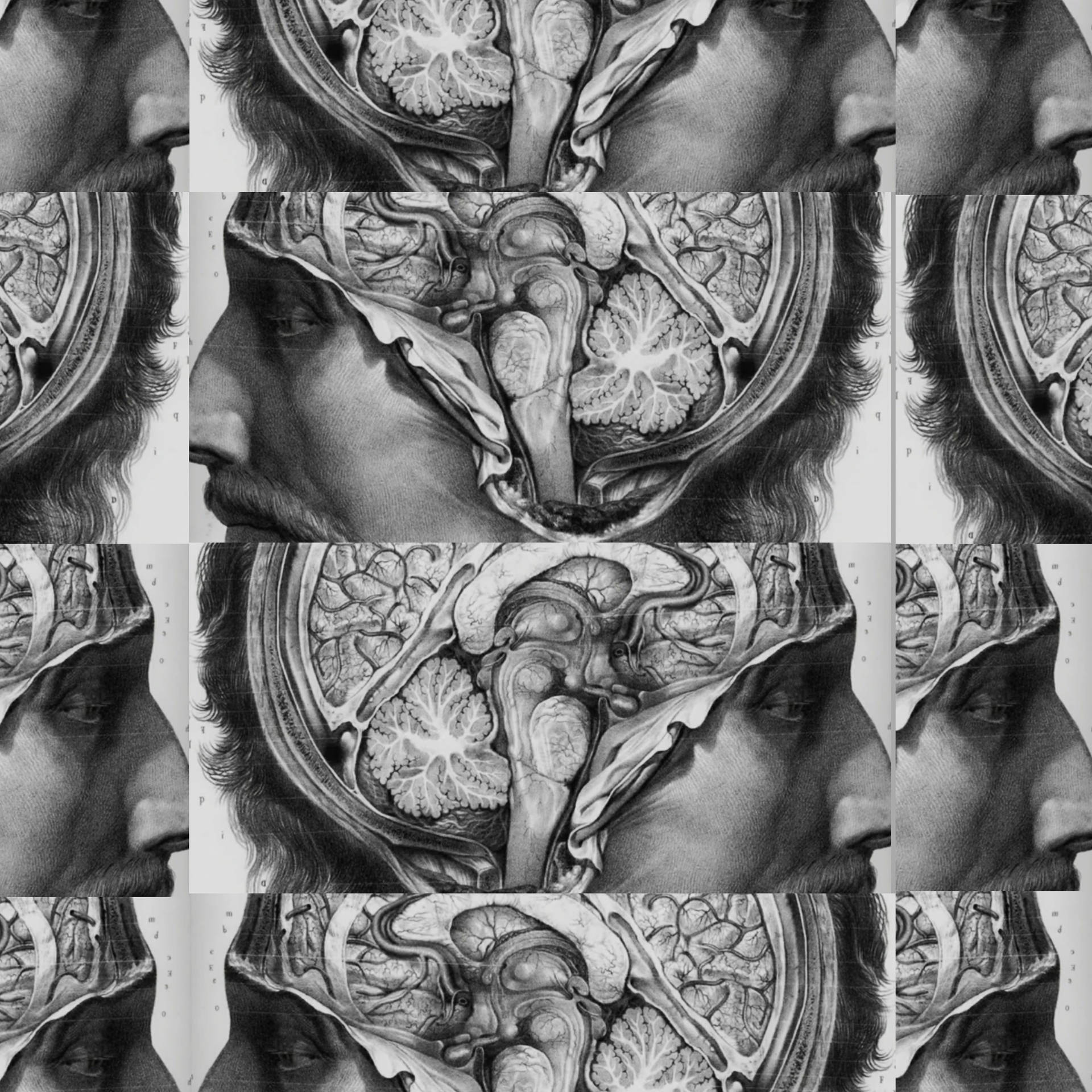 解剖插圖，顯示男人的大腦透過重複網格中切開的頭骨暴露出來。