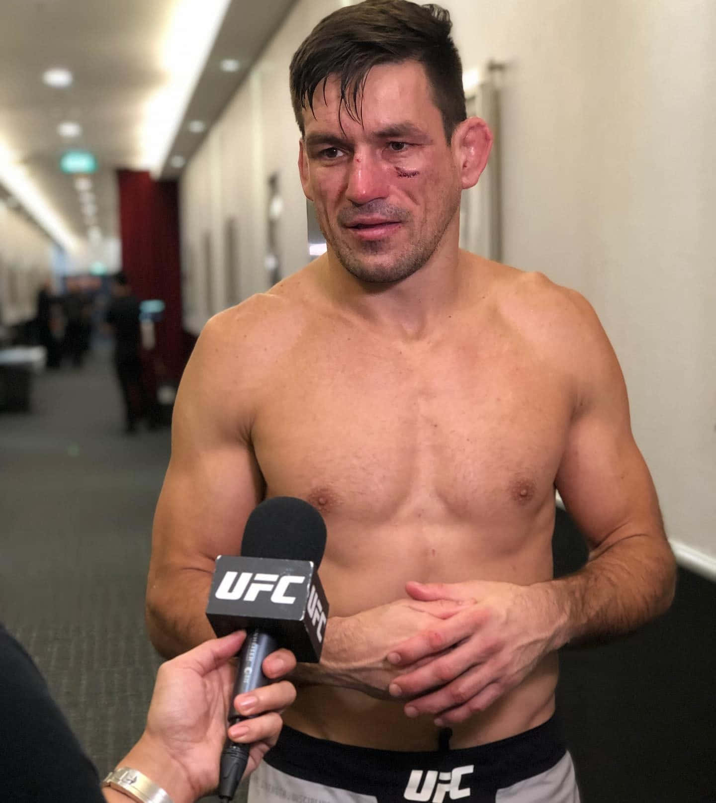 UFC拳手面上有瘀傷揸住咪高峰喺比賽之後