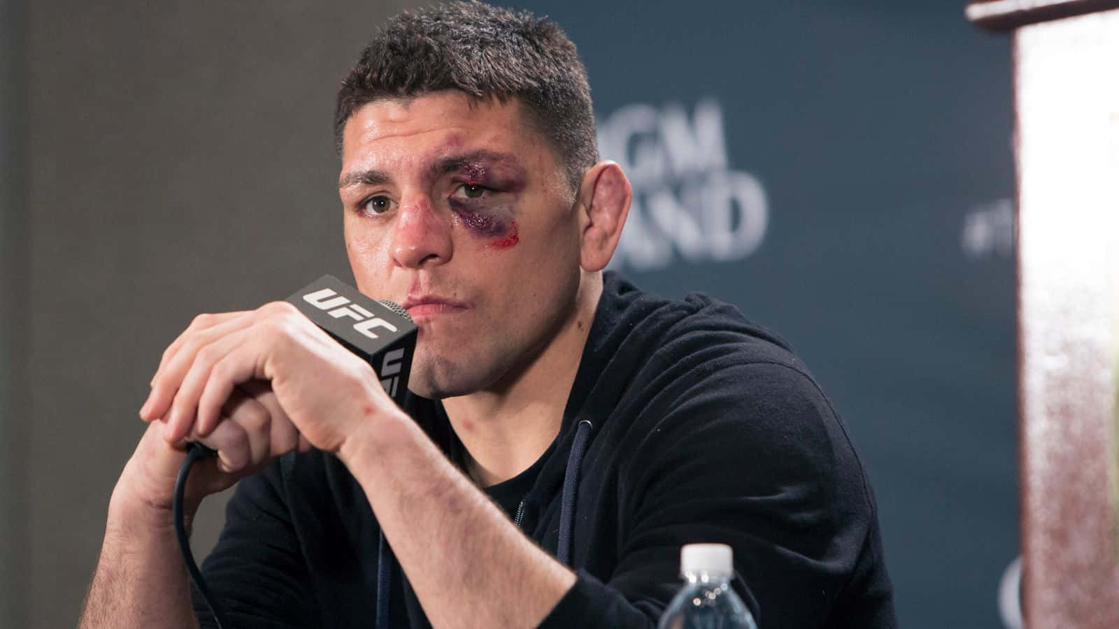 UFC拳手帶着黑眼圈在記者會上對着麥克風說話。