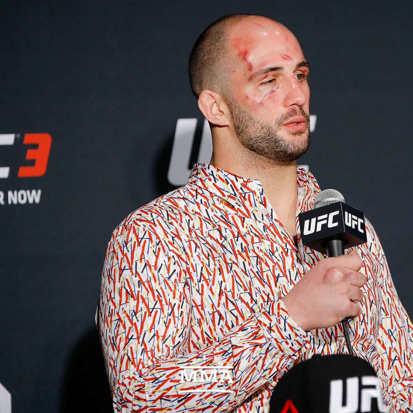 UFC拳手臉部瘀傷，在記者會上對著麥克風發言。