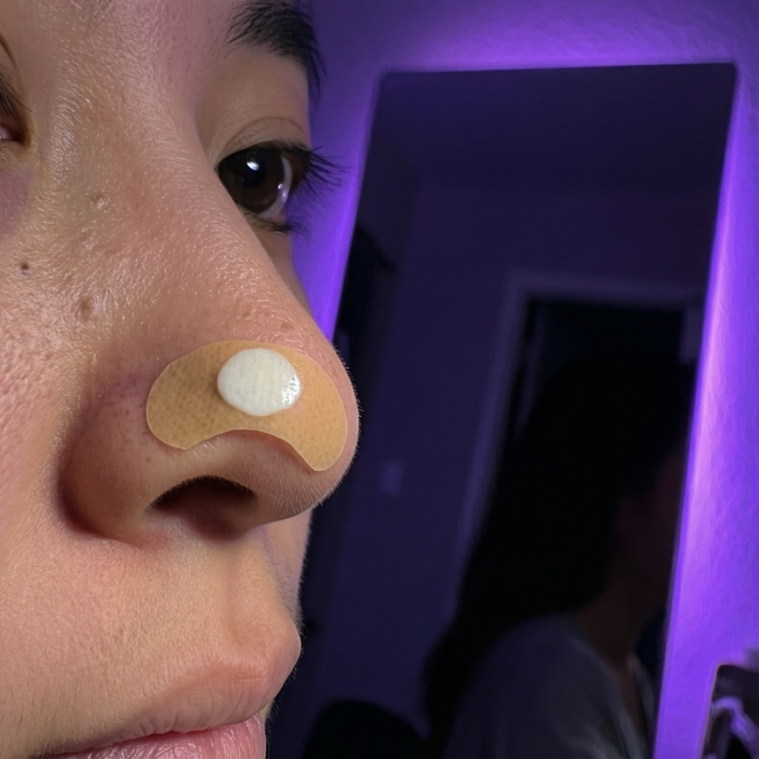 在紫色燈光下，一個人鼻子的特寫，帶有醫療繃帶和白色貼片。