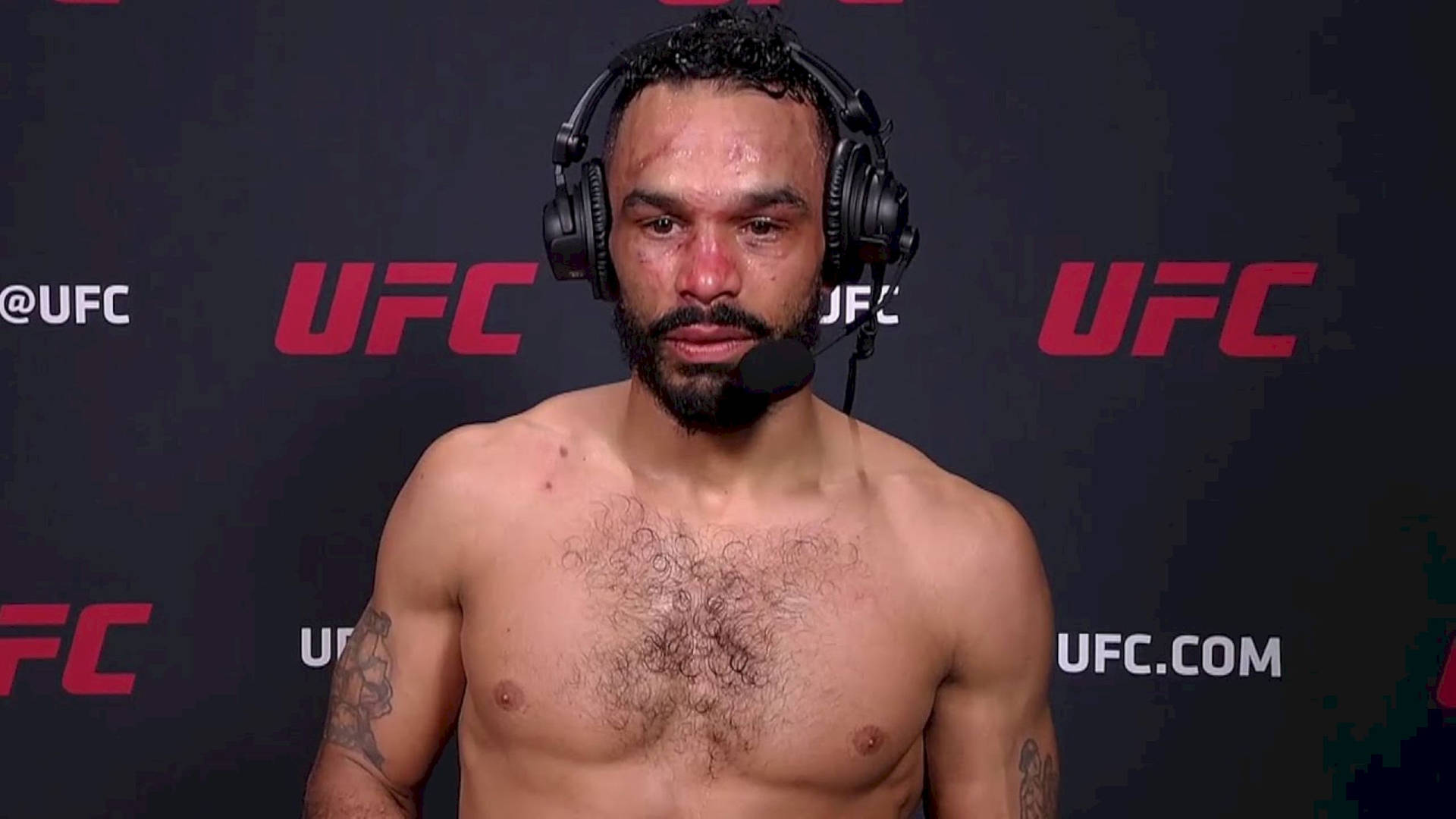 UFC拳手臉部瘀傷戴耳機賽後訪問