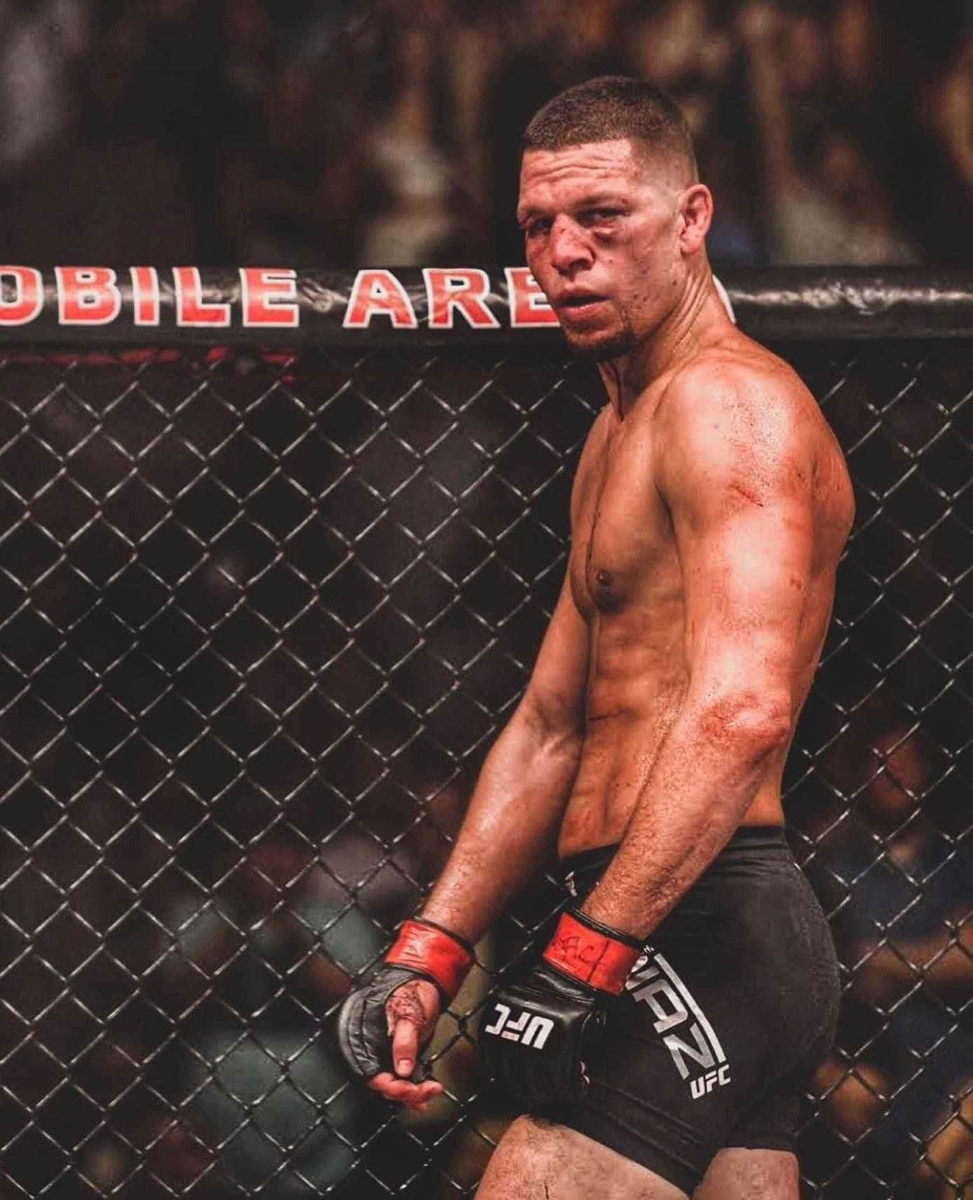 一名瘀傷的MMA選手穿著UFC裝備，在比賽後靠在八角籠上。