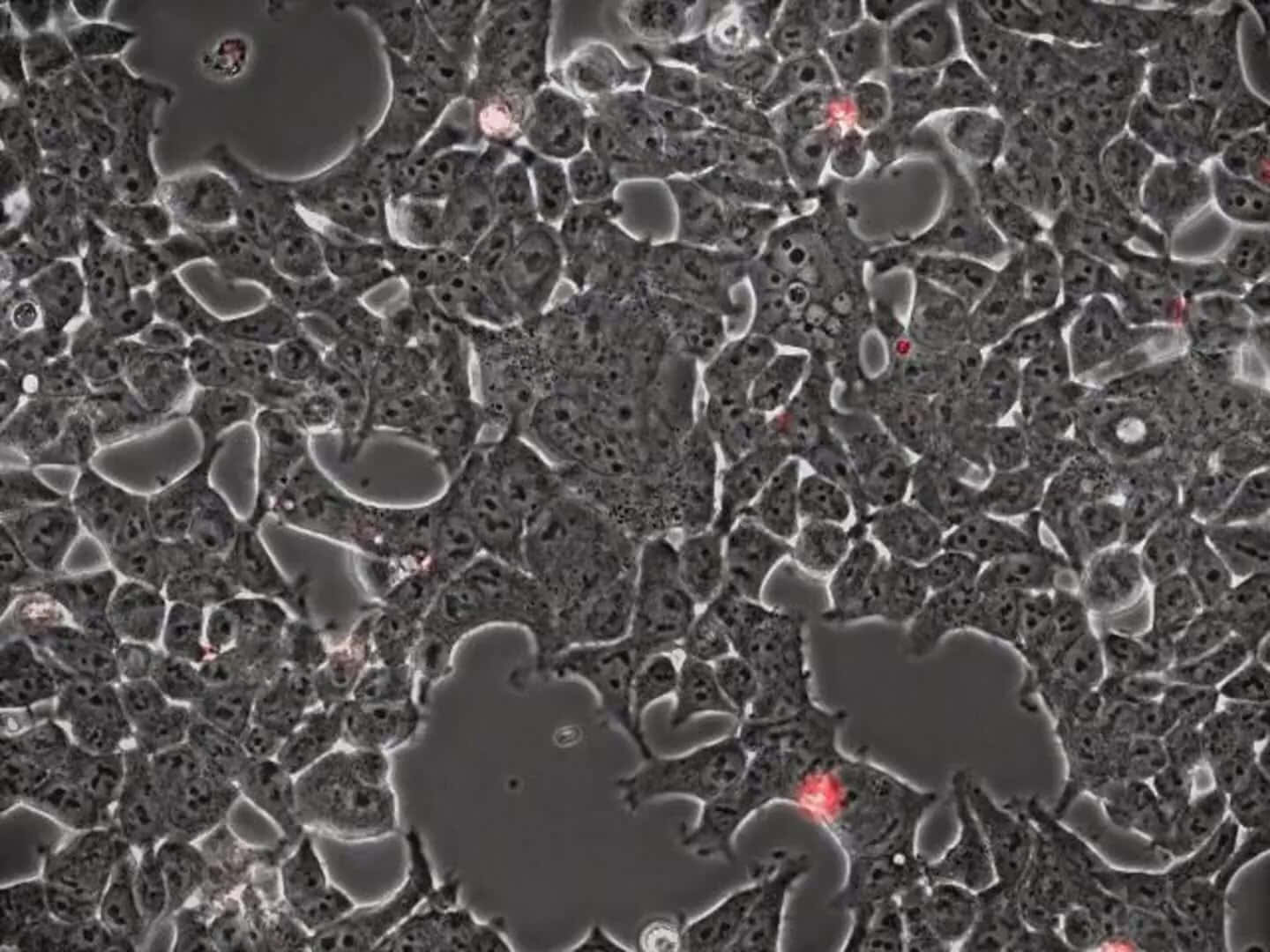 顯微鏡下帶有紅色螢光標記的生物細胞特寫。