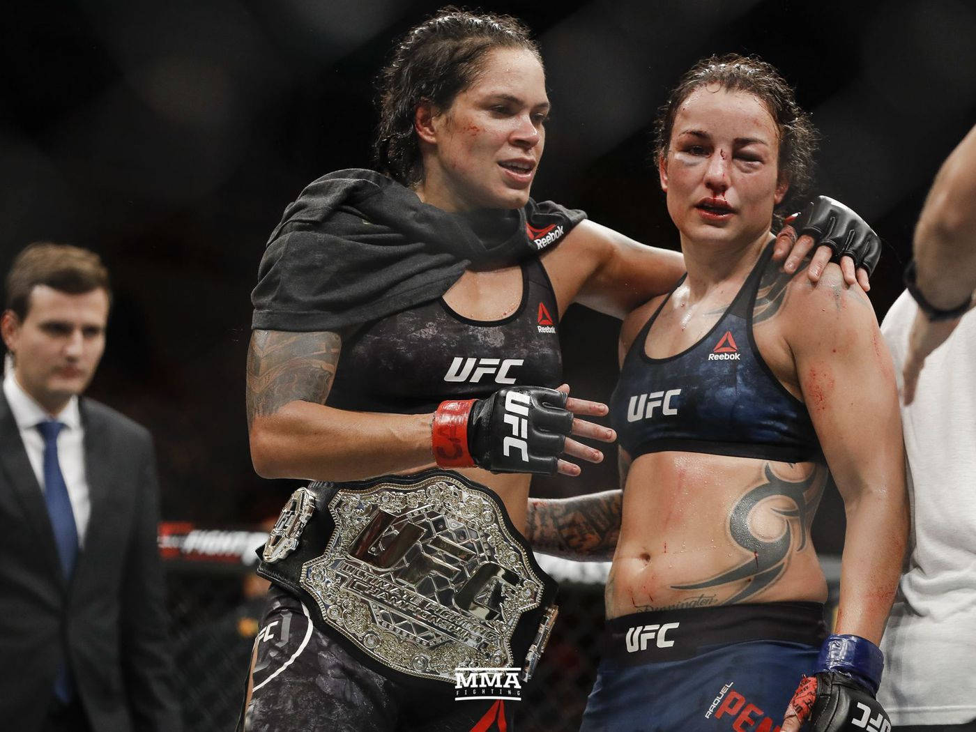 兩名女性MMA拳手在血腥的UFC比賽後擁抱，其中一人手持冠軍腰帶。