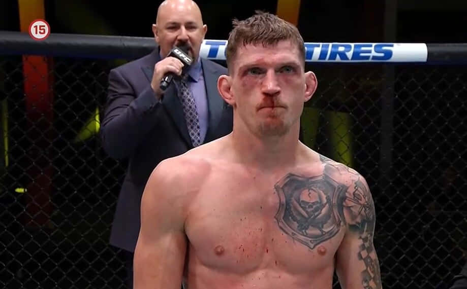 賽後訪問中，八角籠內胸口有紋身、血跡斑斑的MMA拳手。
