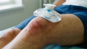 一名男性受傷的膝蓋，敷上冰袋以消腫和化瘀。