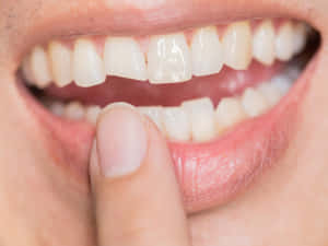 一個人的嘴巴，手指觸碰牙齒附近的下唇。 — 4:3 壁紙