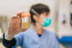 醫護專業人員在實驗室中拿著尿液樣本瓶