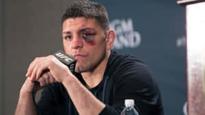 UFC拳手帶着黑眼圈在記者會上對着麥克風說話。